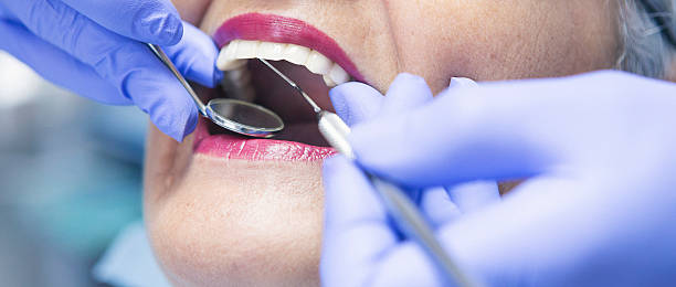 Best Emergency Treatment for Dental Infections or Abscesses in Hilltop, SC